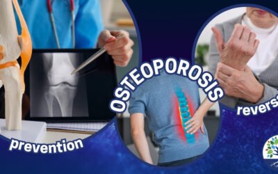 Osteoporosis – A Functional Medicine Approach