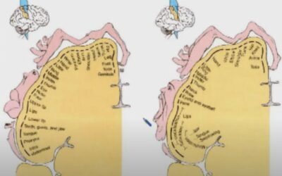 When a “Sinus Infection” is a Neck Problem