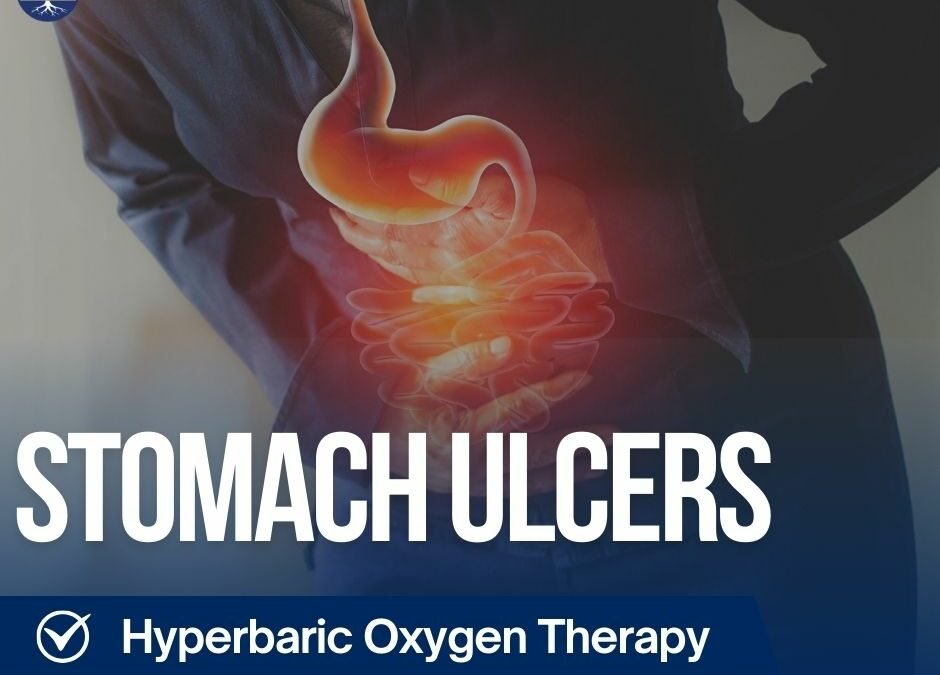 Heal Stomach Ulcers Naturally: The Hyperbaric Oxygen Solution