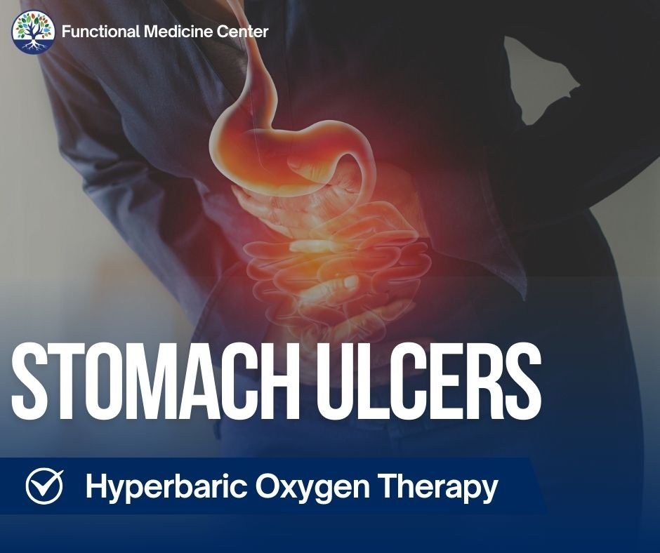 Heal Stomach Ulcers Hyperbaric Oxygen Solution