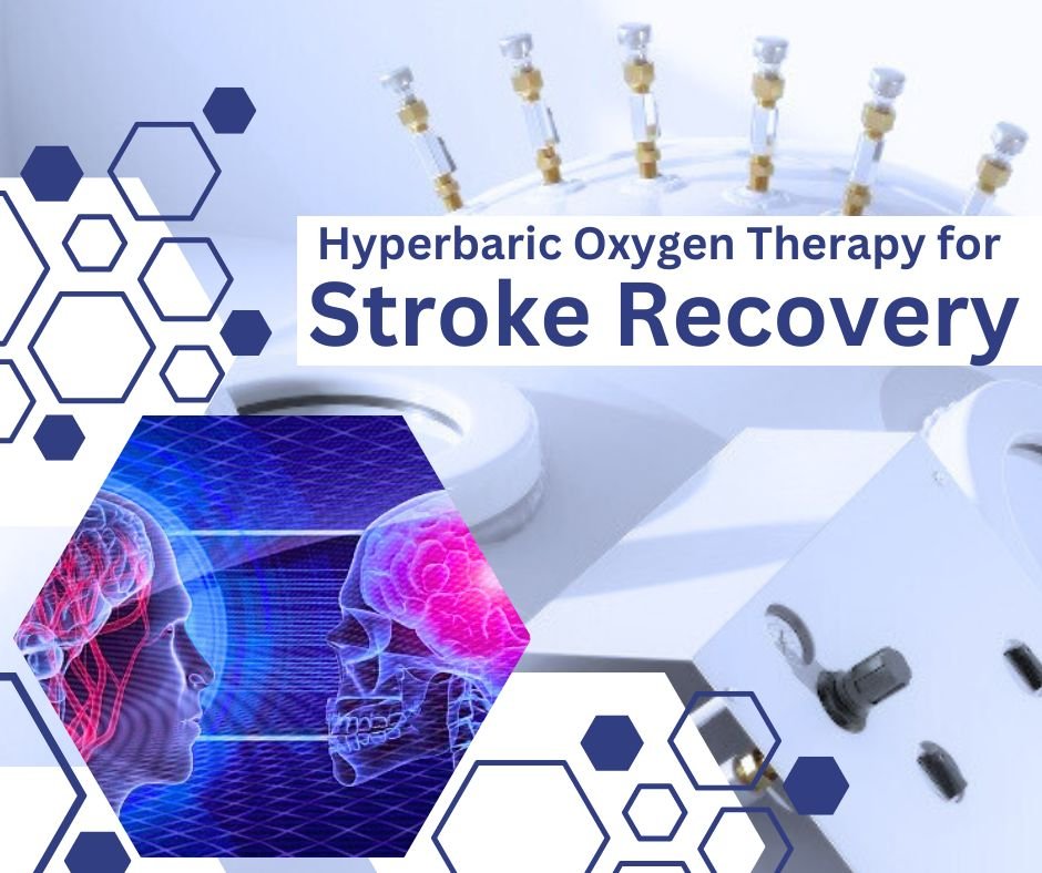 How to use Hyperbaric Oxygen Therapy for Stroke Recovery