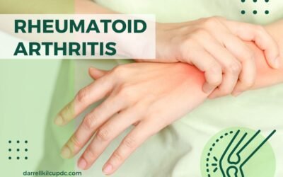Rheumatoid Arthritis Doctors Near Me