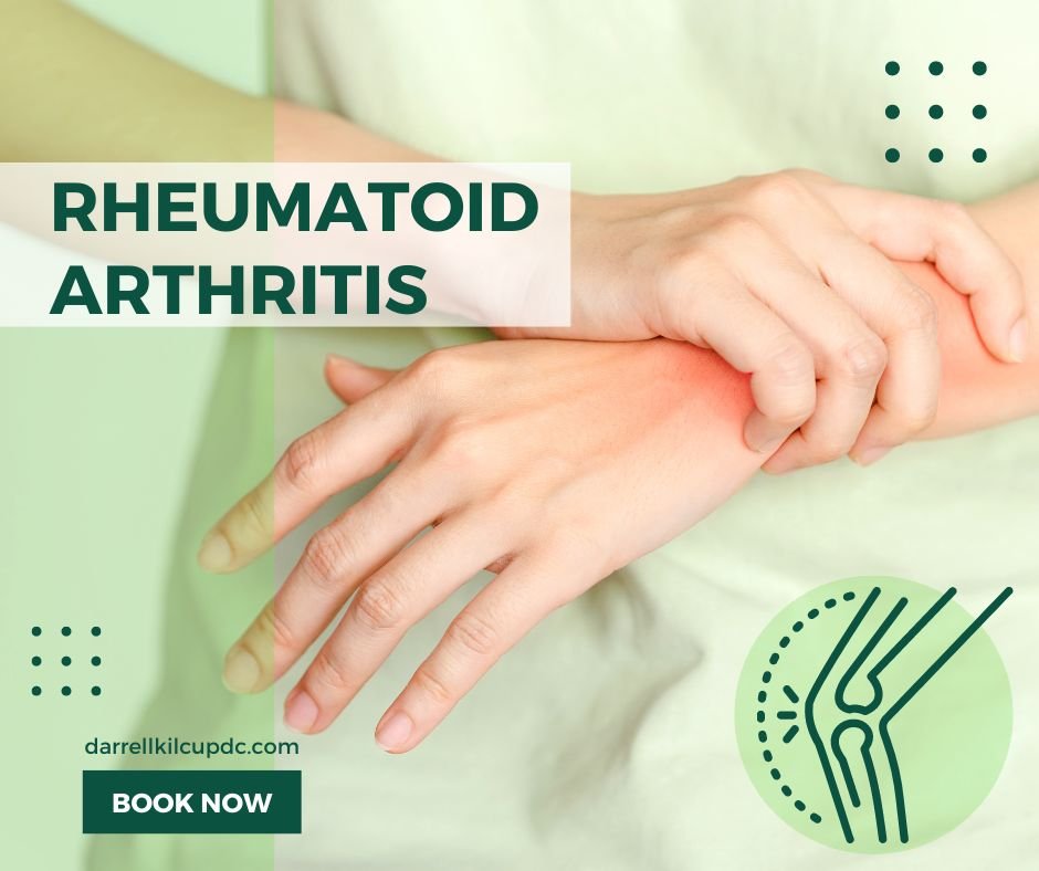 Rheumatoid Arthritis Doctors Near Me - Dr.Darrell Kilcup