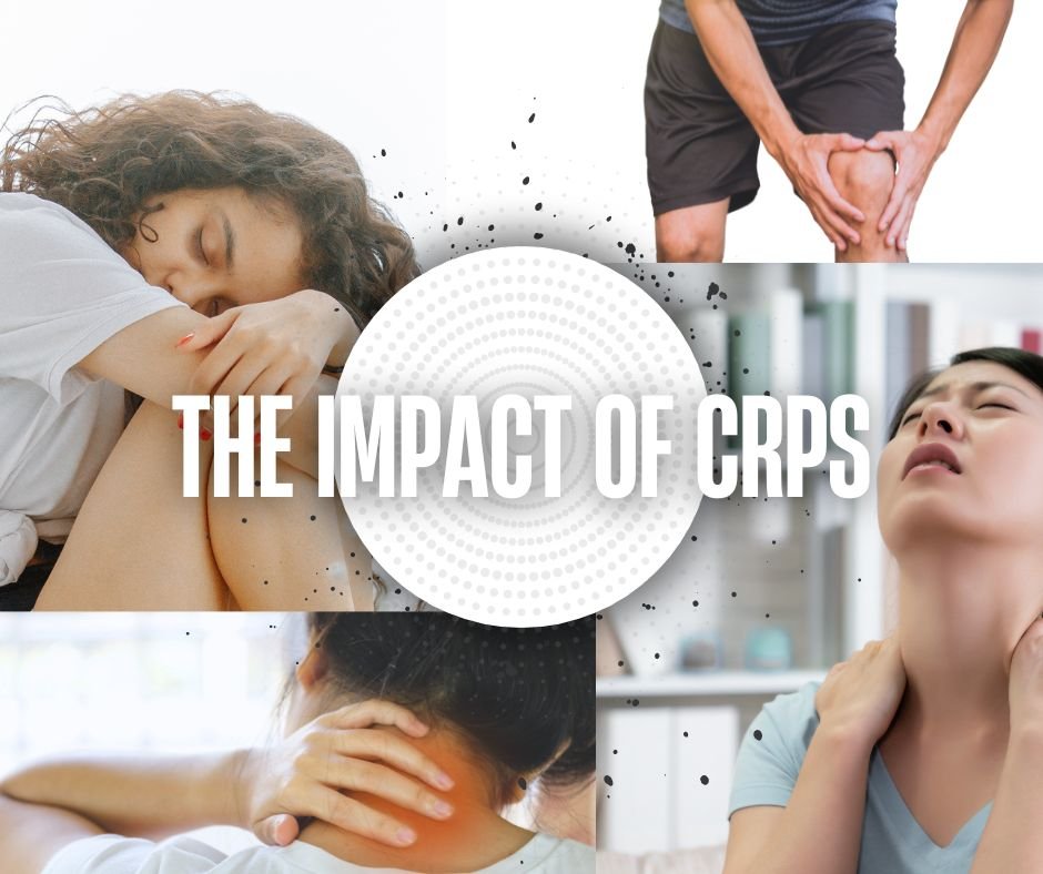 CRPS Life Expectancy