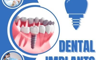 Bone Graft for Dental Implant?