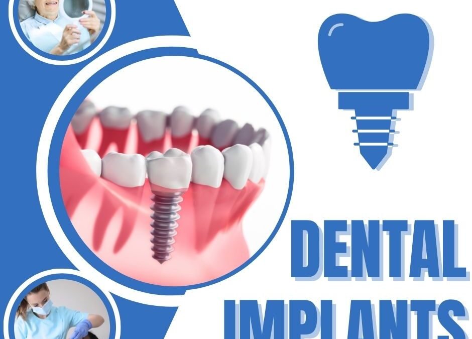Bone Graft for Dental Implant?