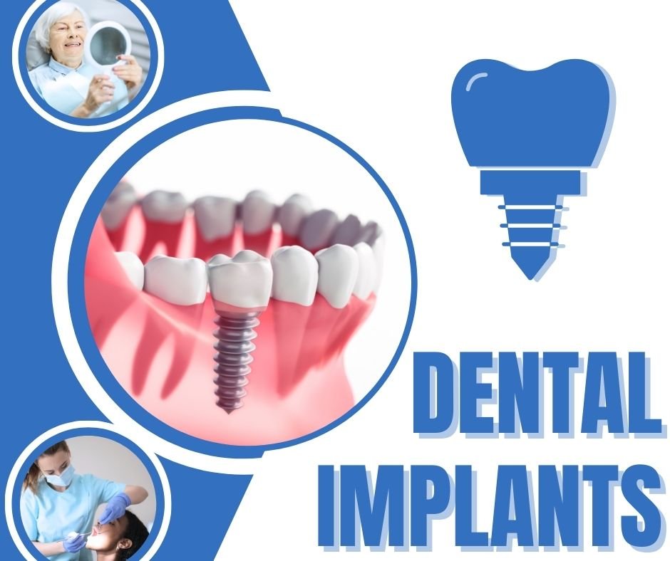 bone graft for dental implant
