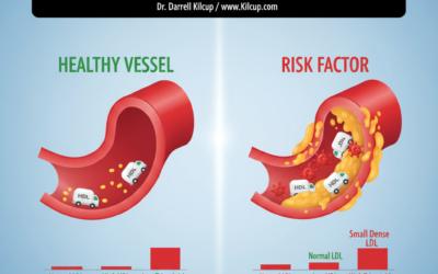 How Low HDL and High Triglycerides Increase Stroke Risk — Even When LDL Is Normal