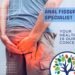 anal fissure specialist